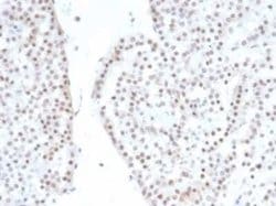 SF-1/NR5A1/Steroidogenic Factor 1 Rabbit anti-Human, Rat, Clone: NR5A1/4368R,